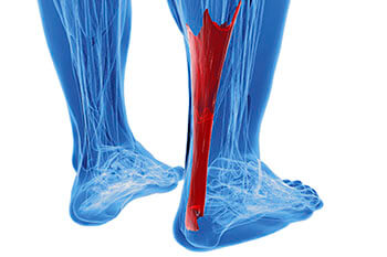 Achilles tendonitis treatment in the Kings County, NY: Brooklyn (Midwood, Bay Ridge, Sunset Park, Bushwick, Park Slope, East New York, Williamsburg, Brighton Beach, Brownsville, Greenpoint, Brooklyn Heights, Kensington), Richmond County, NY: St. George, Midland Beach, and Queens County, NY: Elmhurst, Maspeth, Forest Hills areas